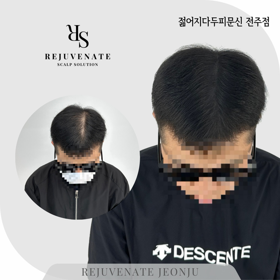 젊어지다