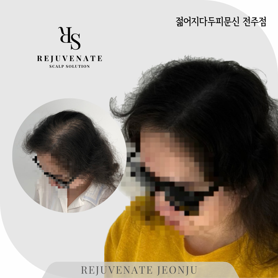 젊어지다
