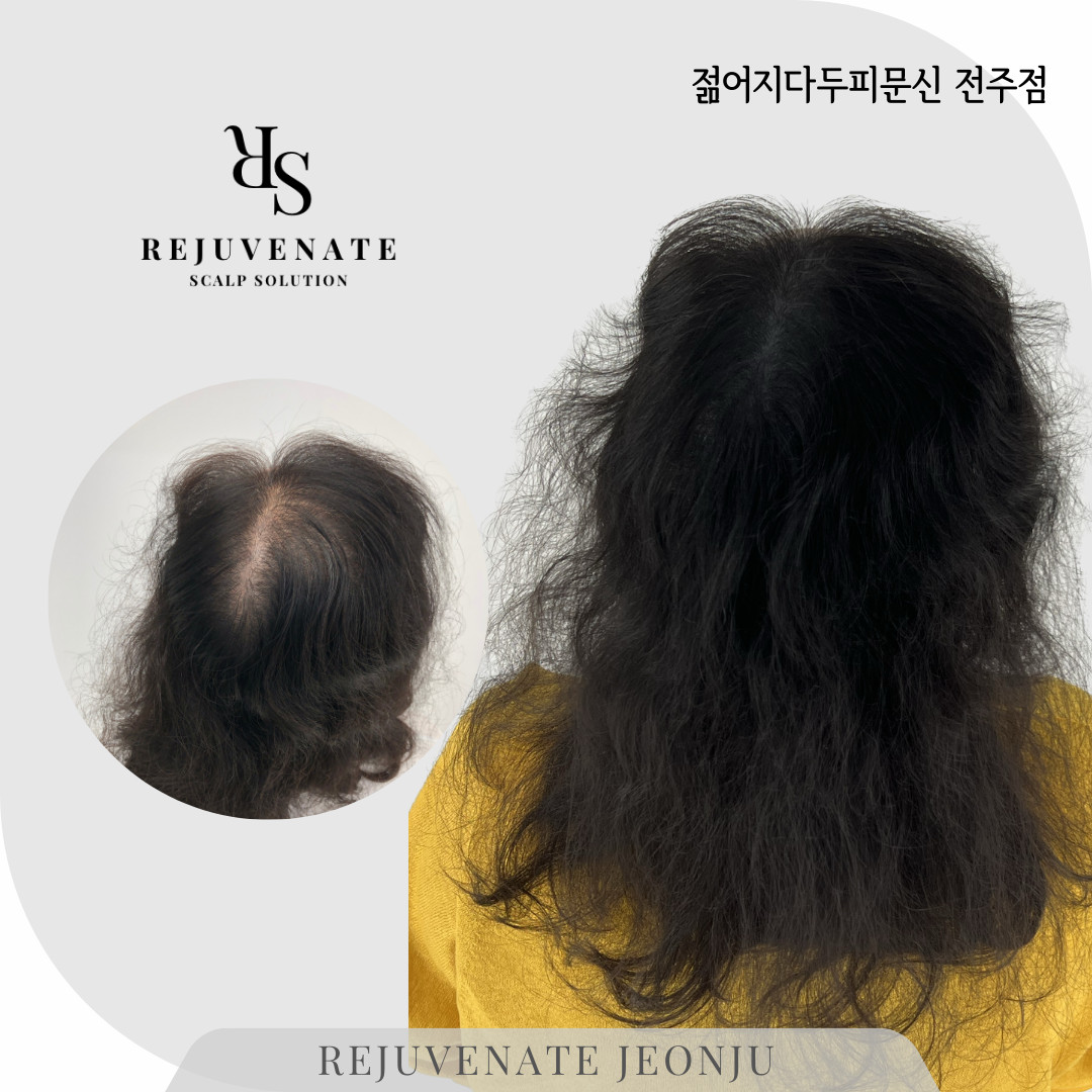 젊어지다