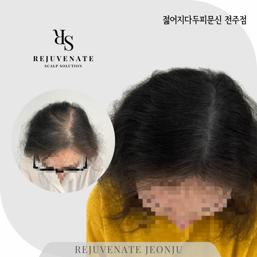 젊어지다