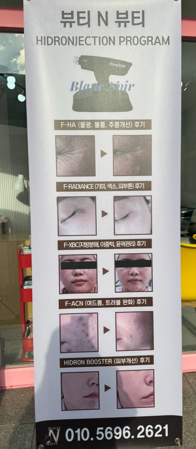 뷰티N뷰티