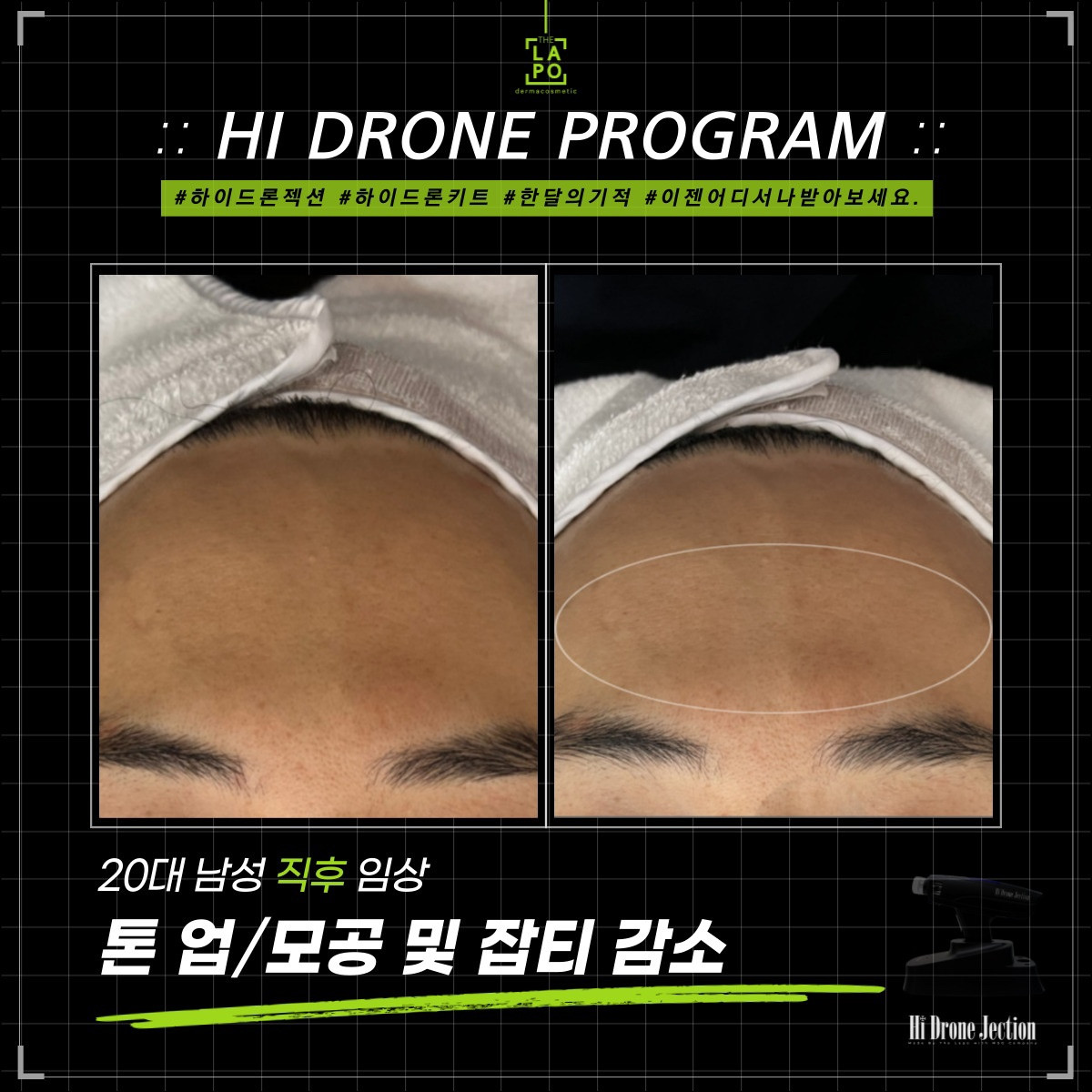 뷰티N뷰티