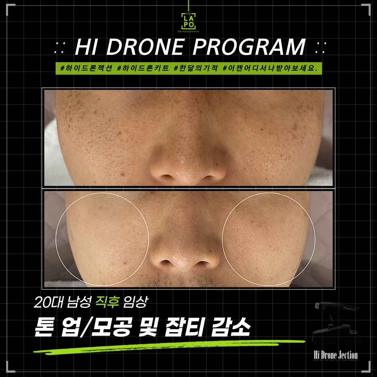 뷰티N뷰티