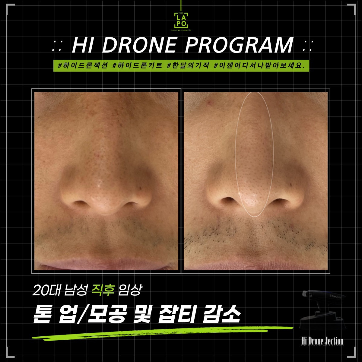 뷰티N뷰티