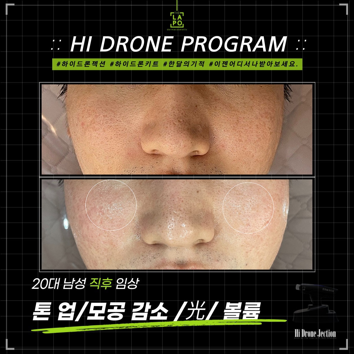 뷰티N뷰티