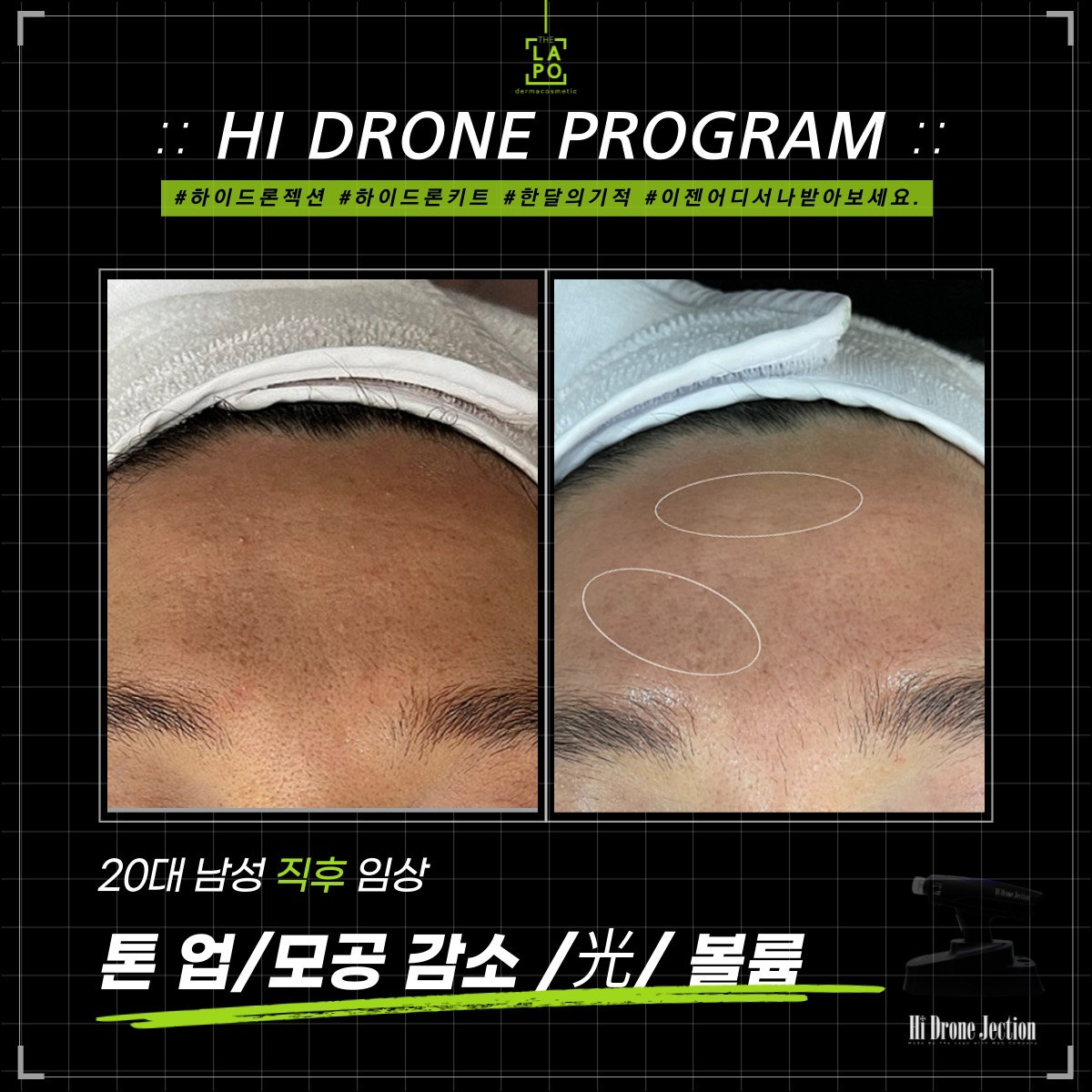 뷰티N뷰티