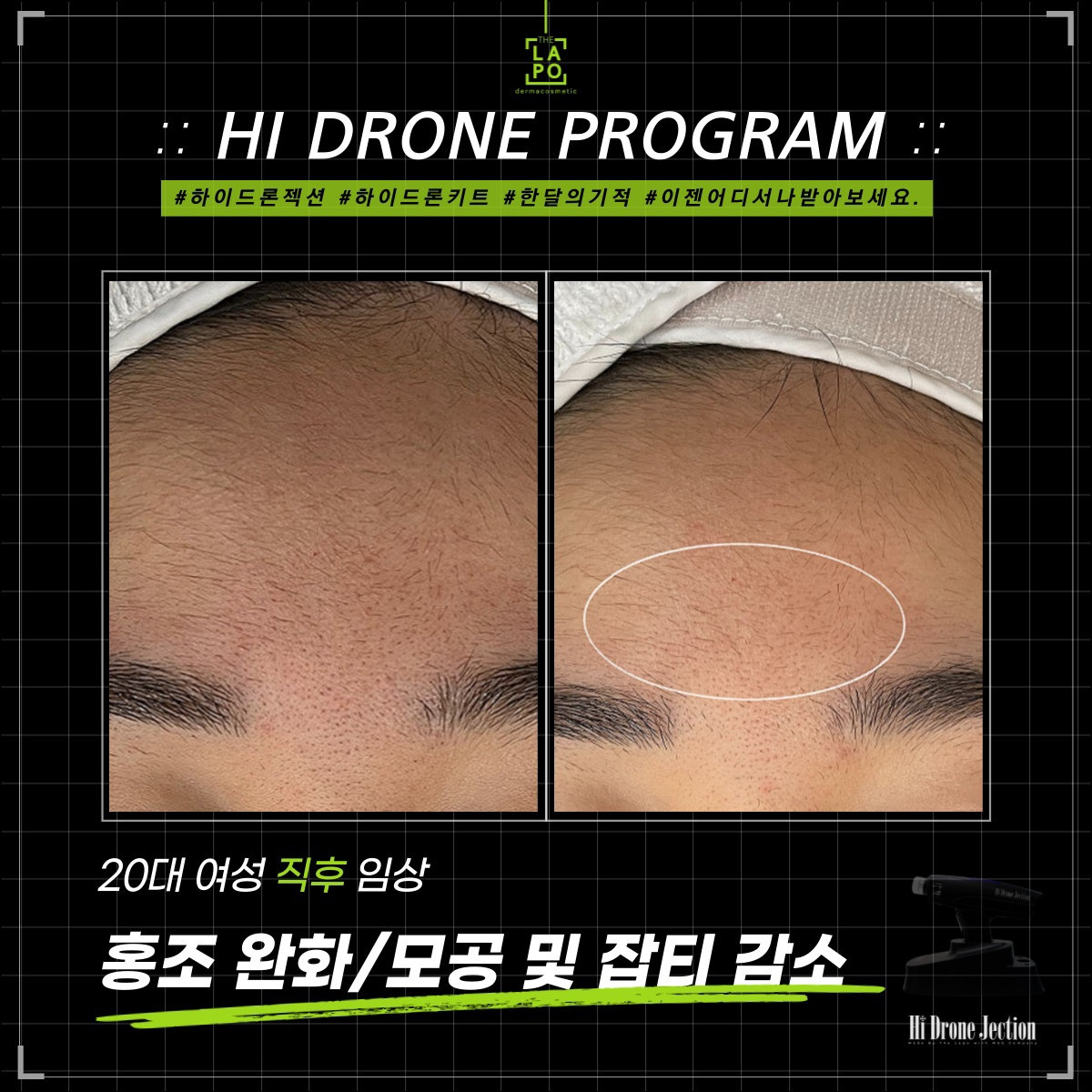 뷰티N뷰티
