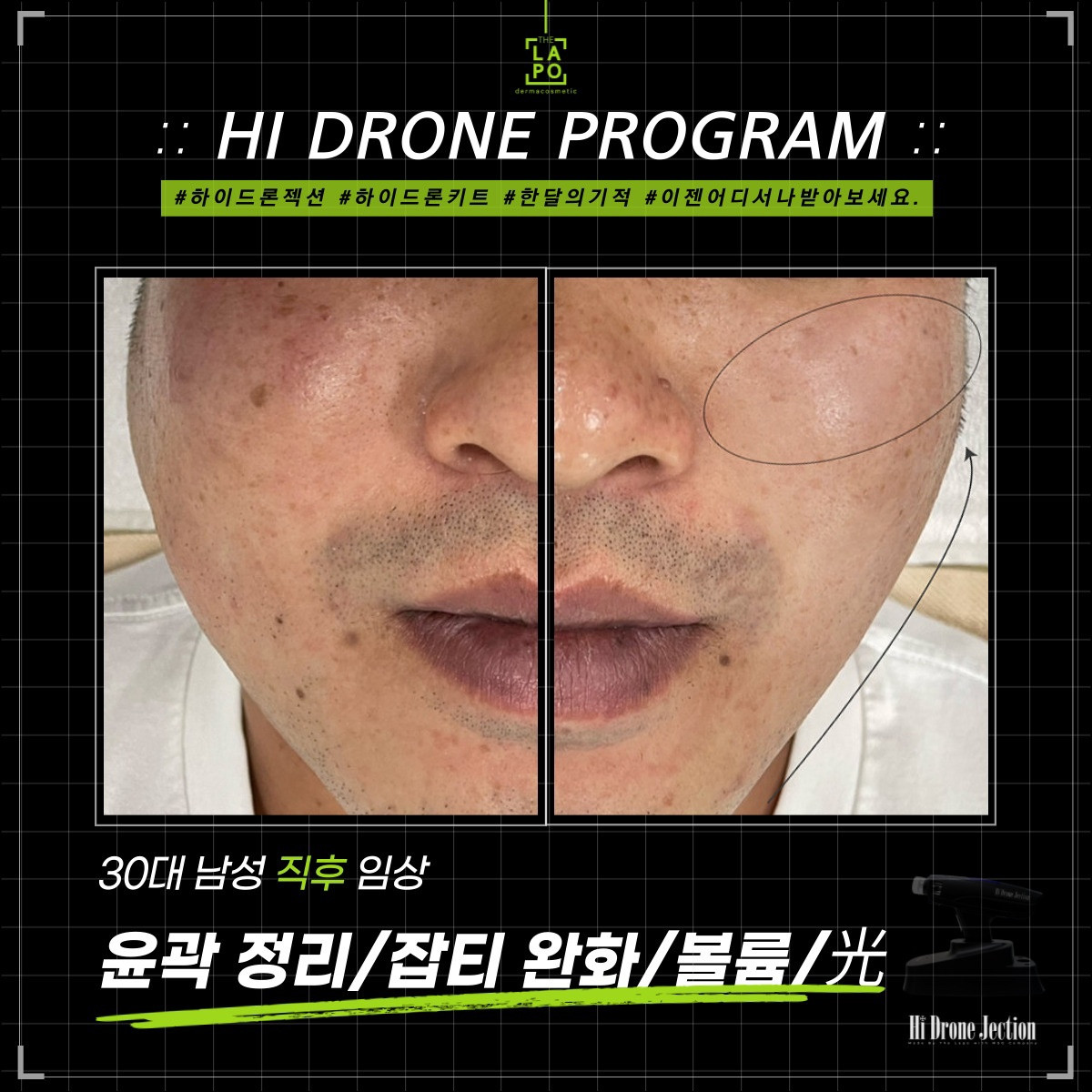 뷰티N뷰티