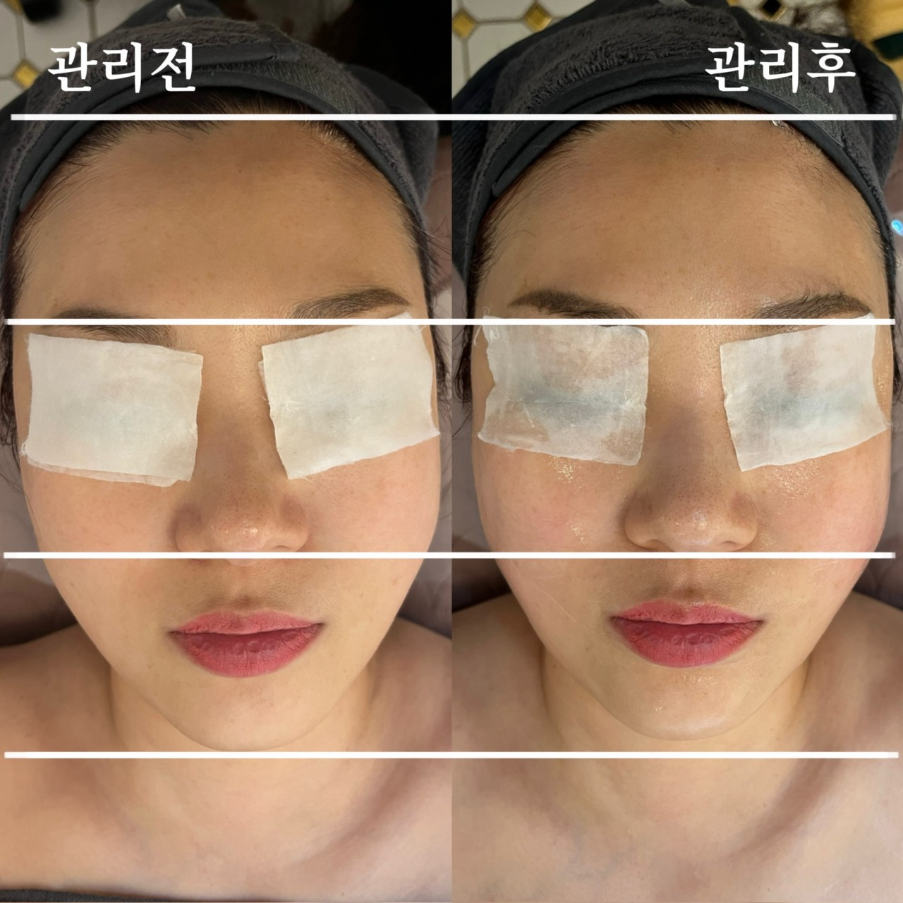 피부가꿈