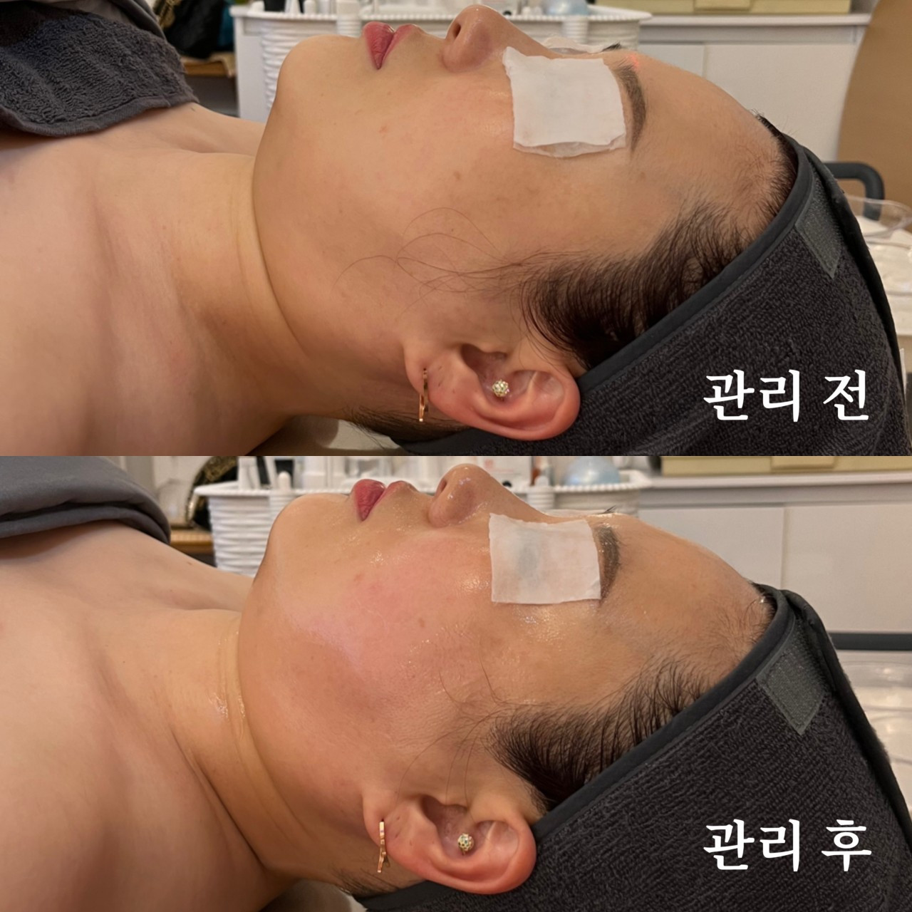 피부가꿈