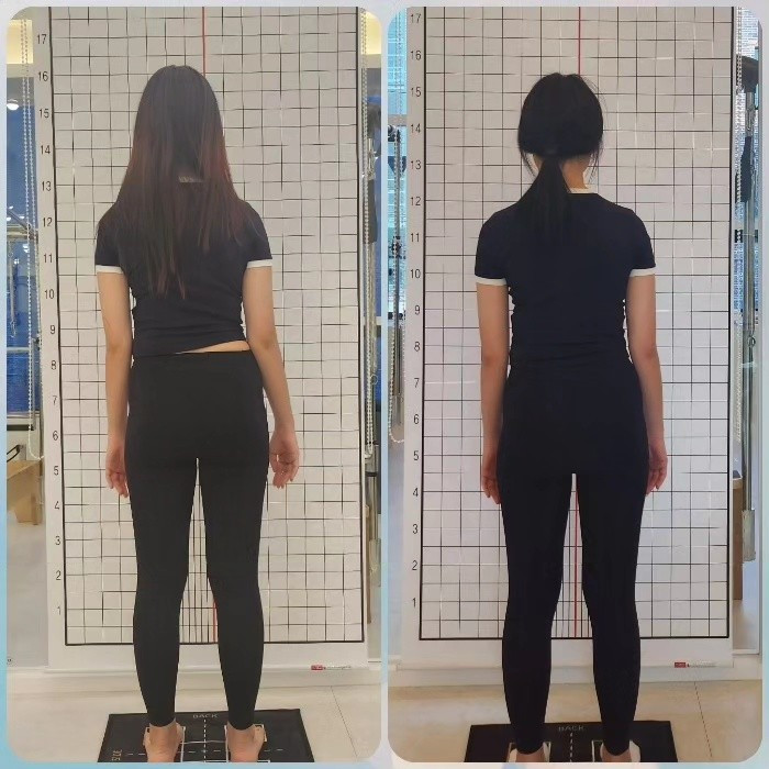 스마일필라테스동구점