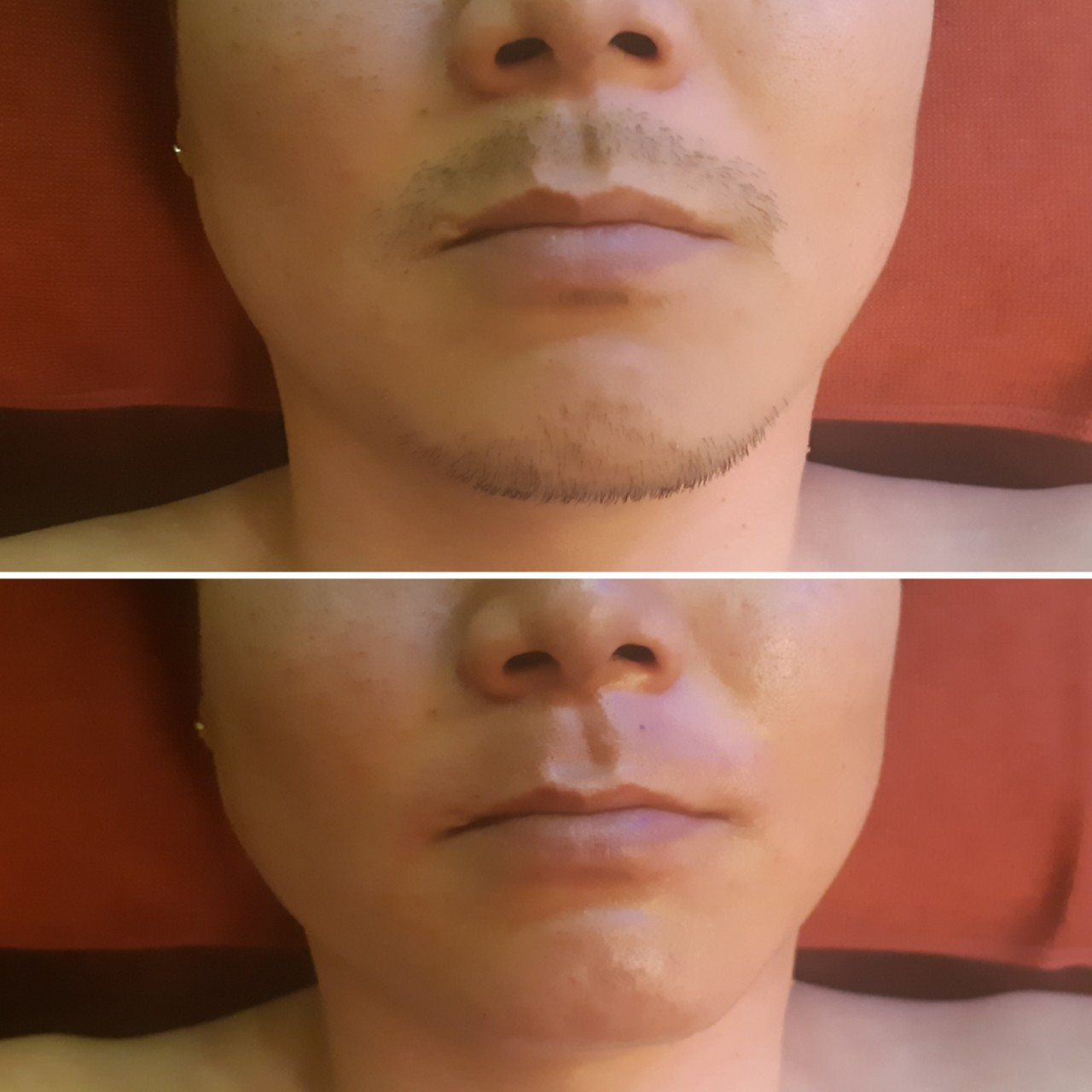 오늘테라피
