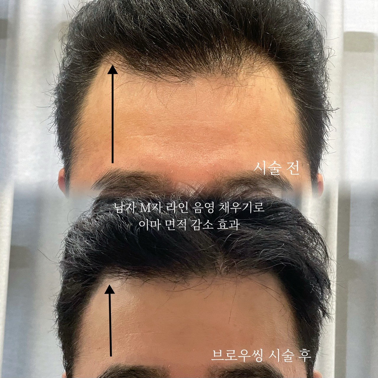 모모도트