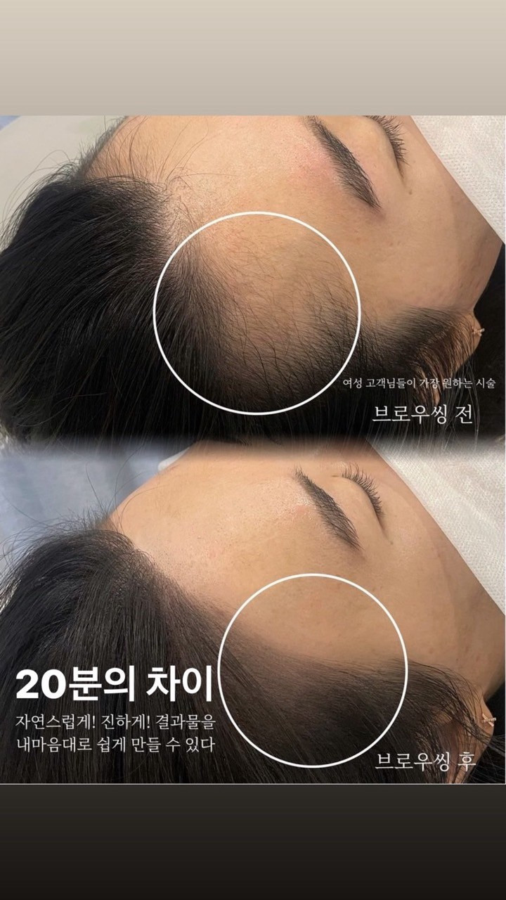 모모도트