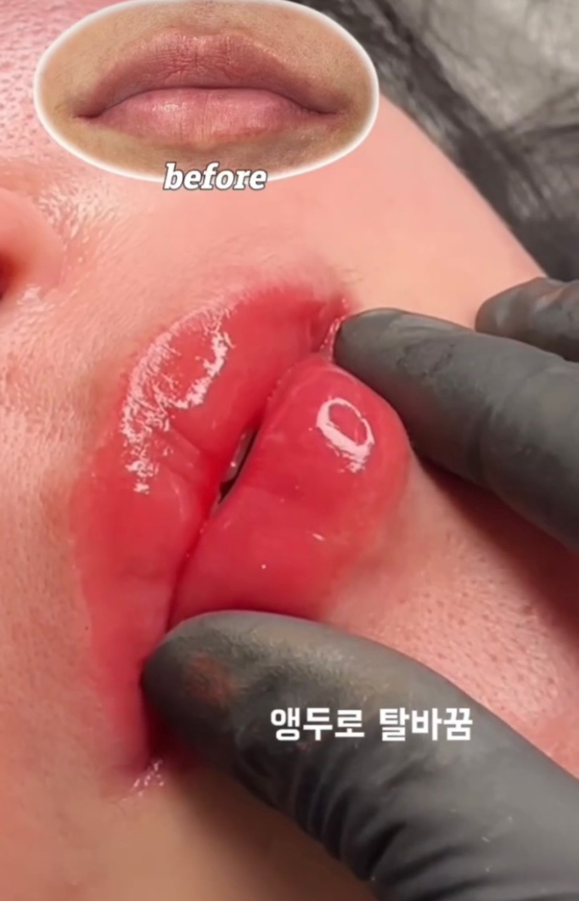 모모도트