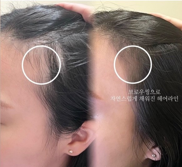 모모도트