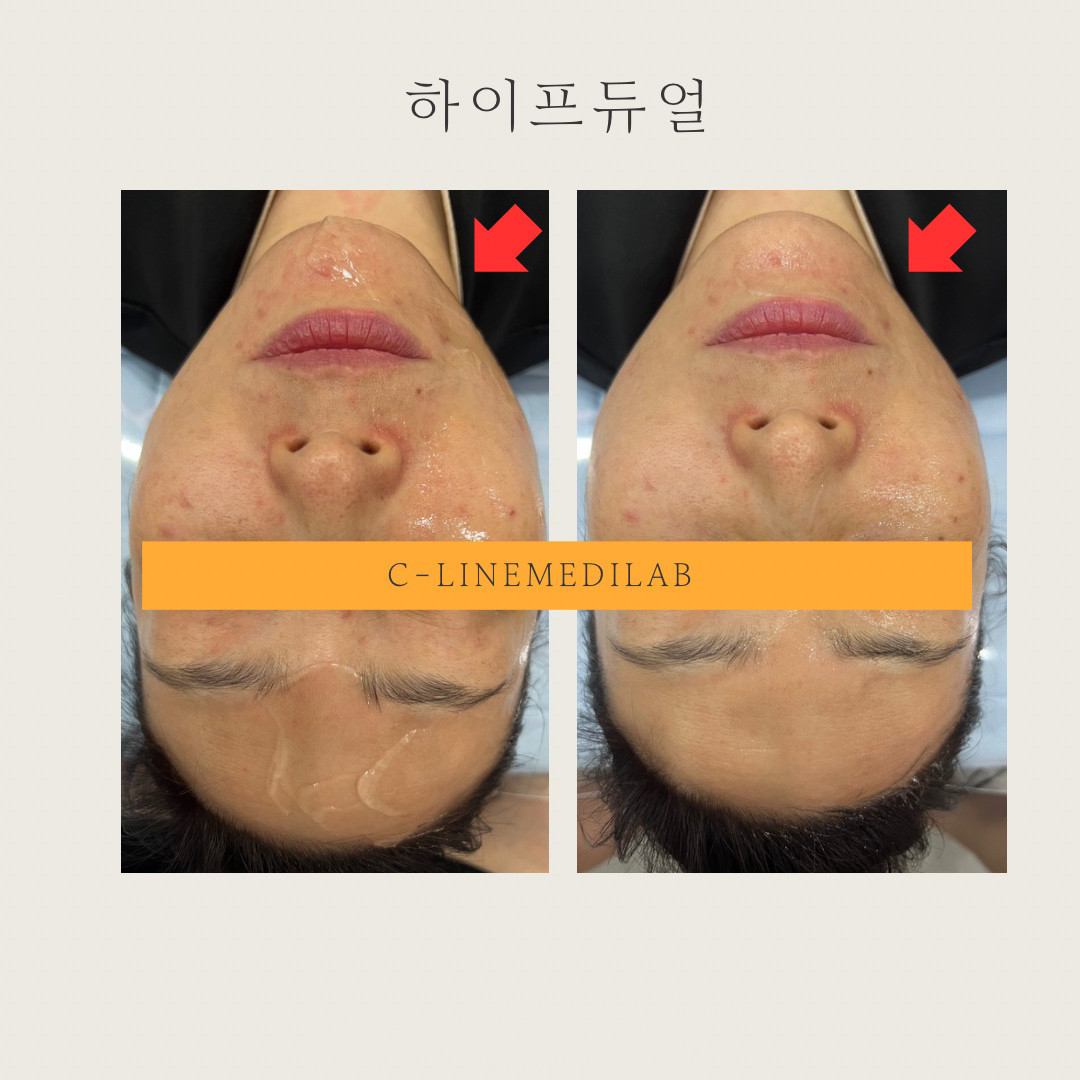 벨로즈뷰티마곡본점