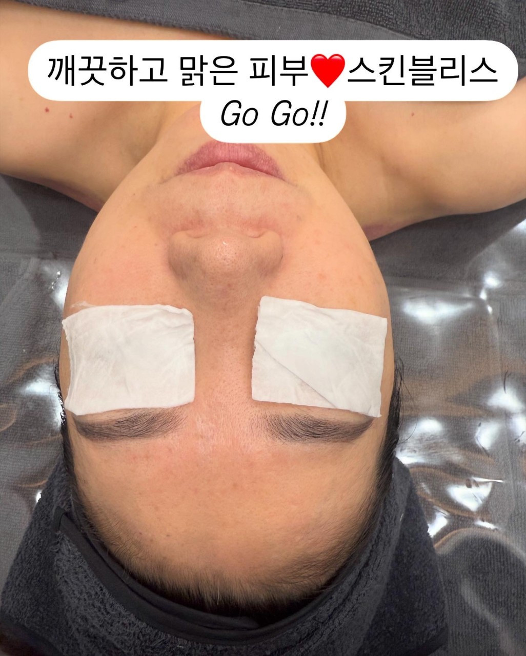 스킨블리스