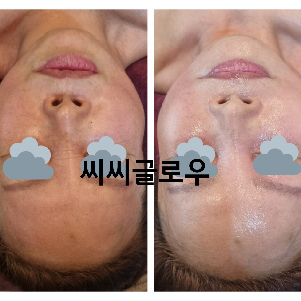 내안의뷰티