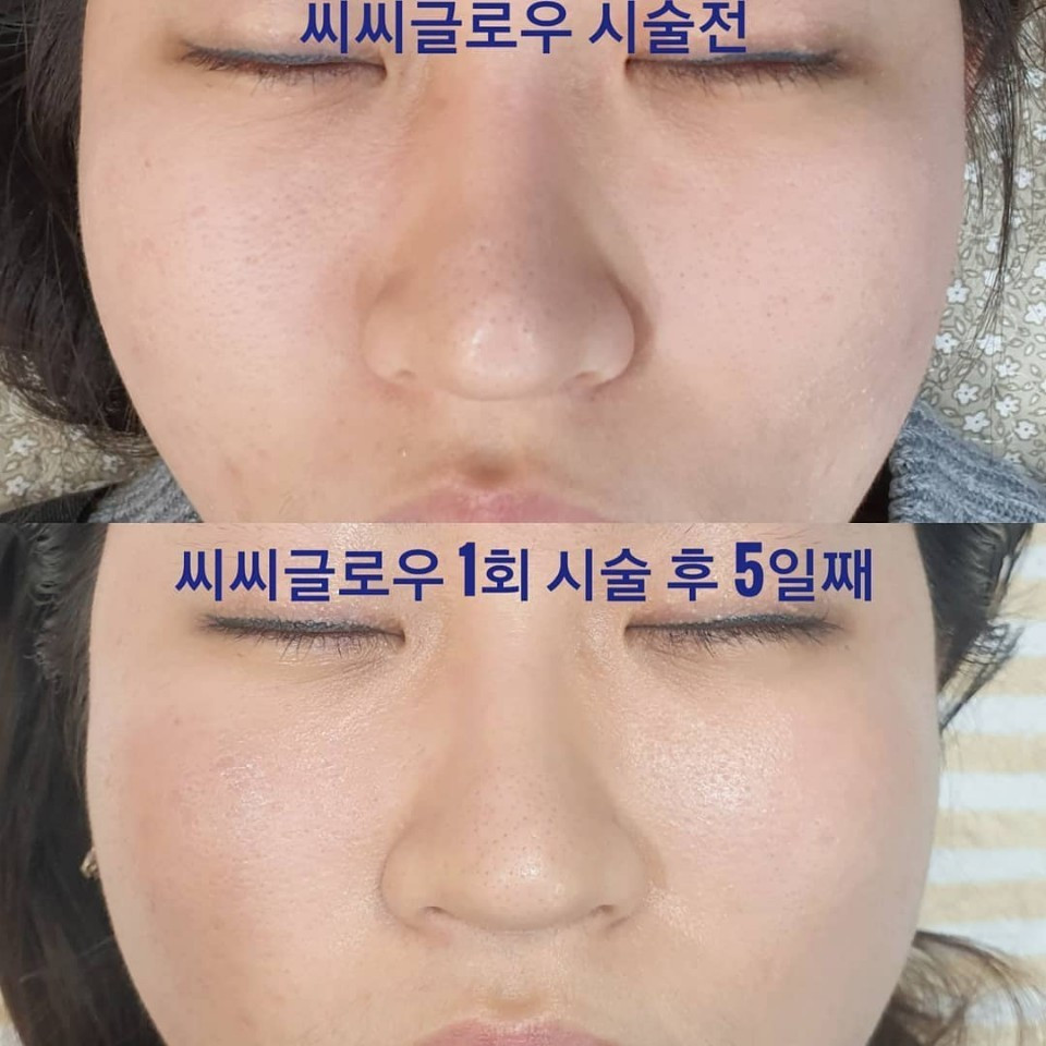 내안의뷰티