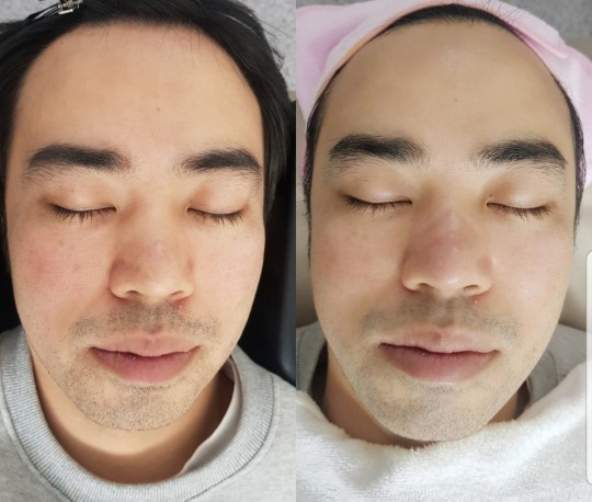 내안의뷰티