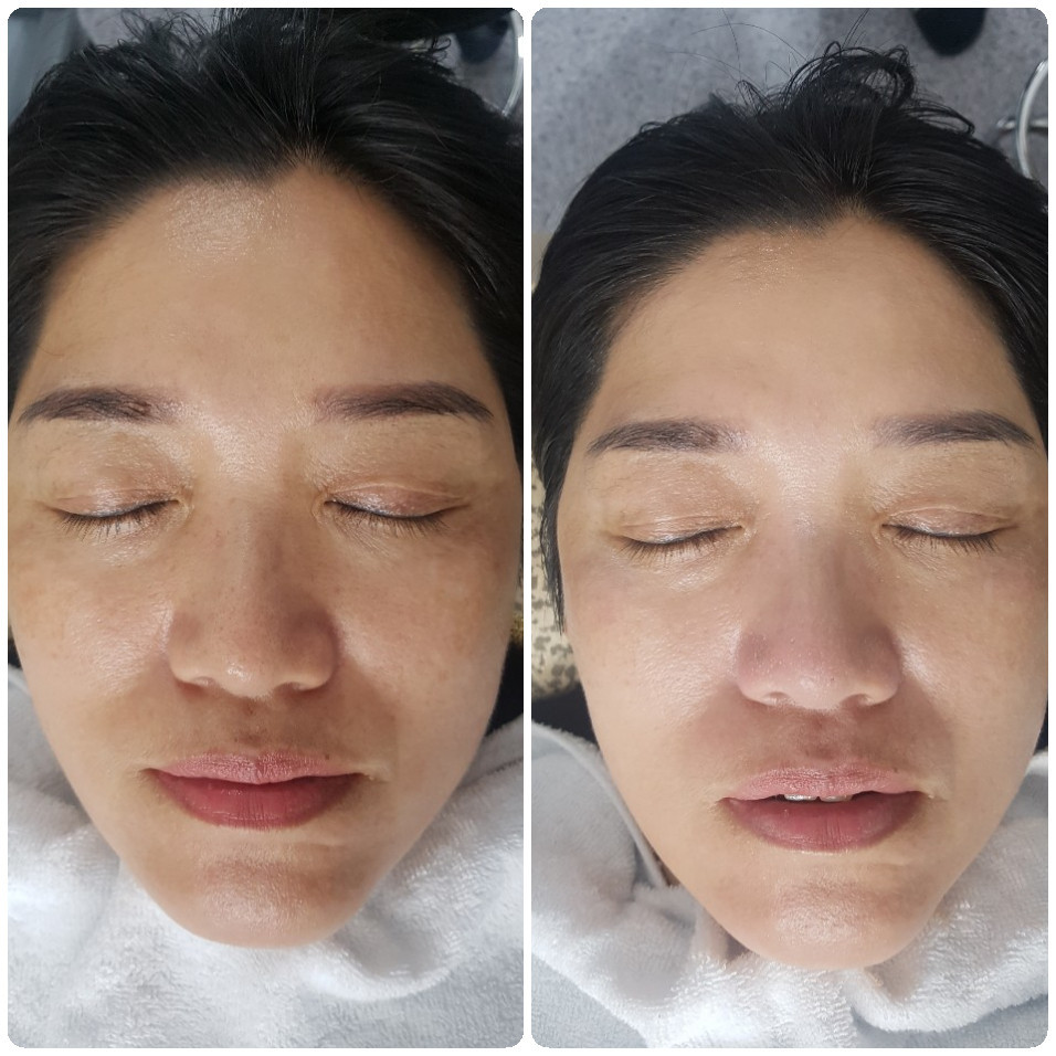 내안의뷰티
