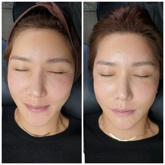 내안의뷰티