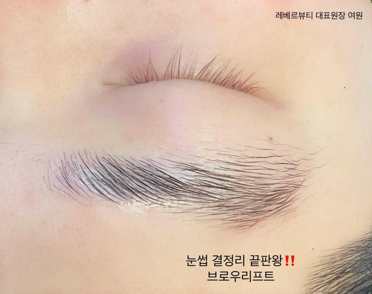 레베르뷰티