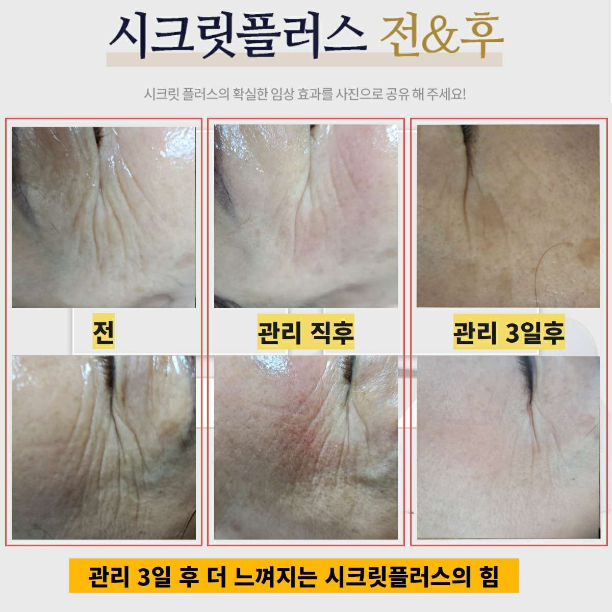비비드라인