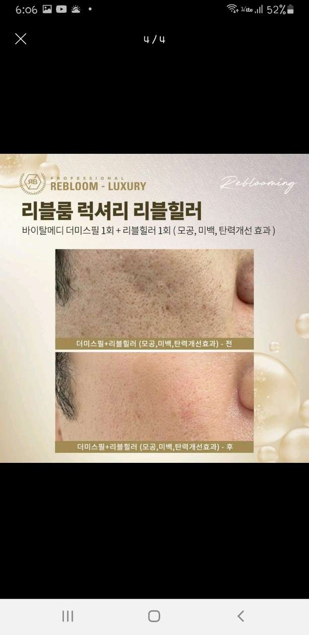 비비드라인