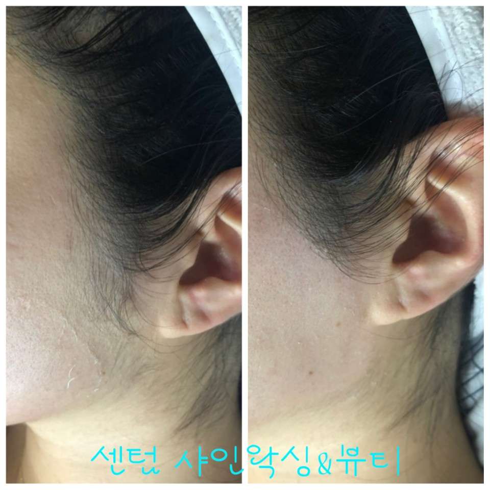 센텀샤인왁싱앤뷰티