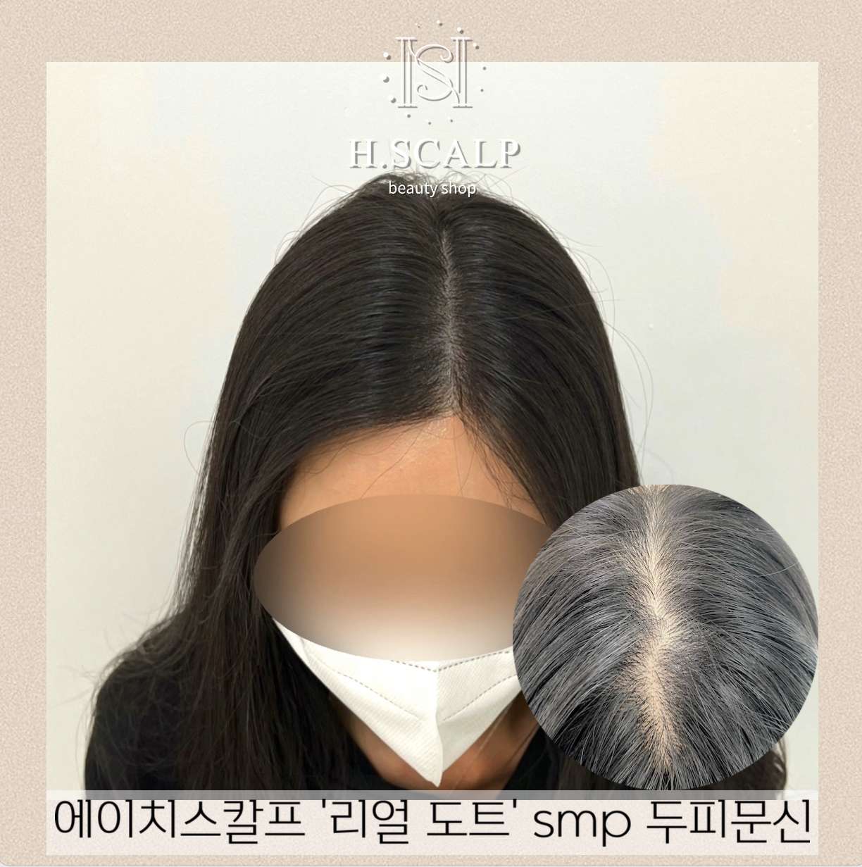 에이치스칼프뷰티샵