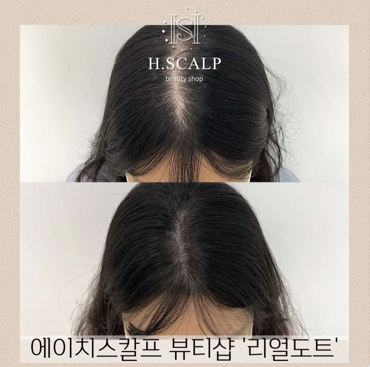 에이치스칼프뷰티샵