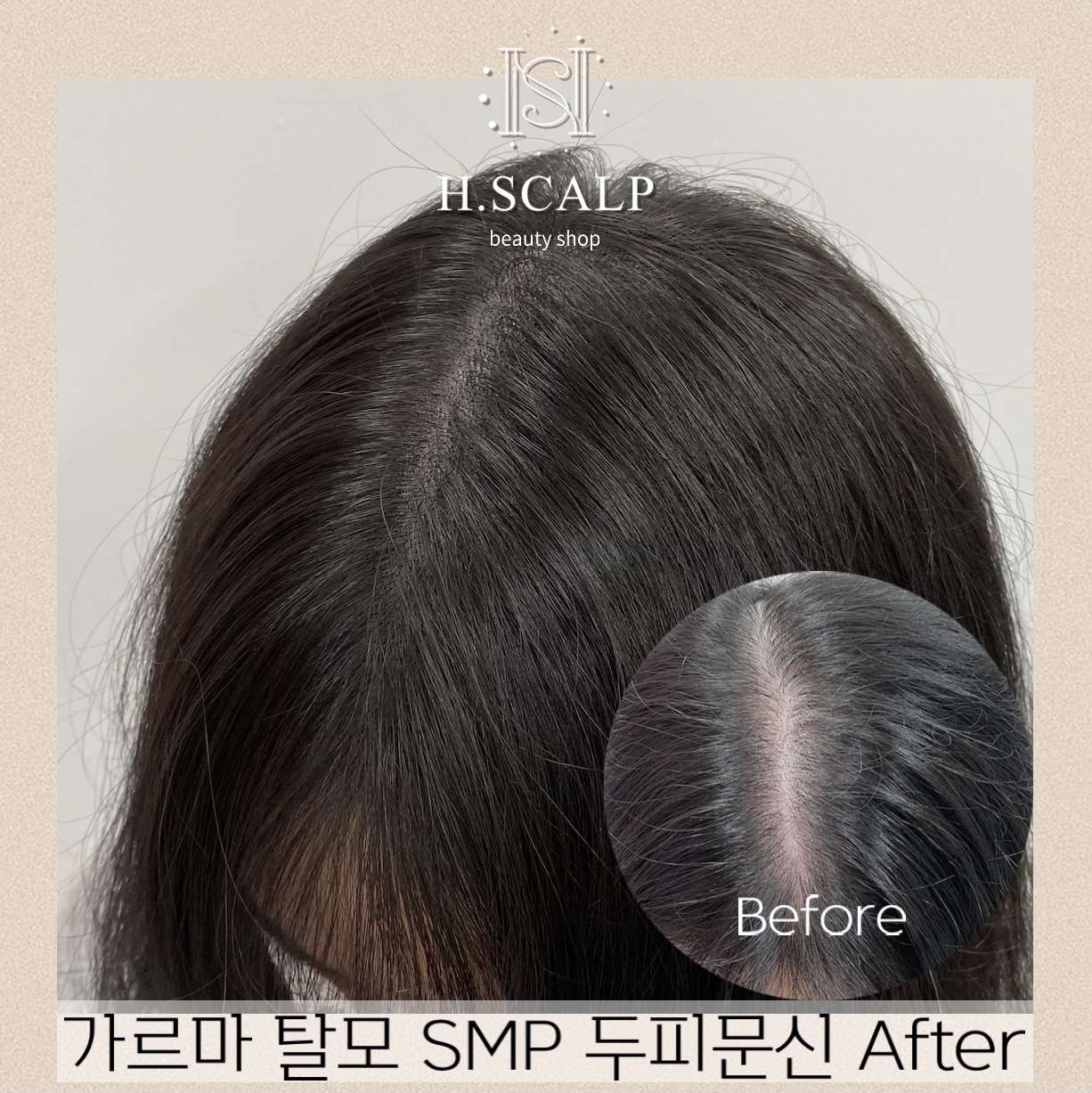 에이치스칼프뷰티샵