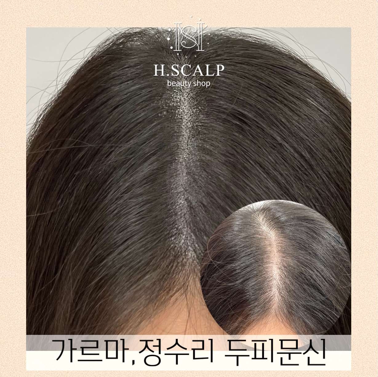 에이치스칼프뷰티샵