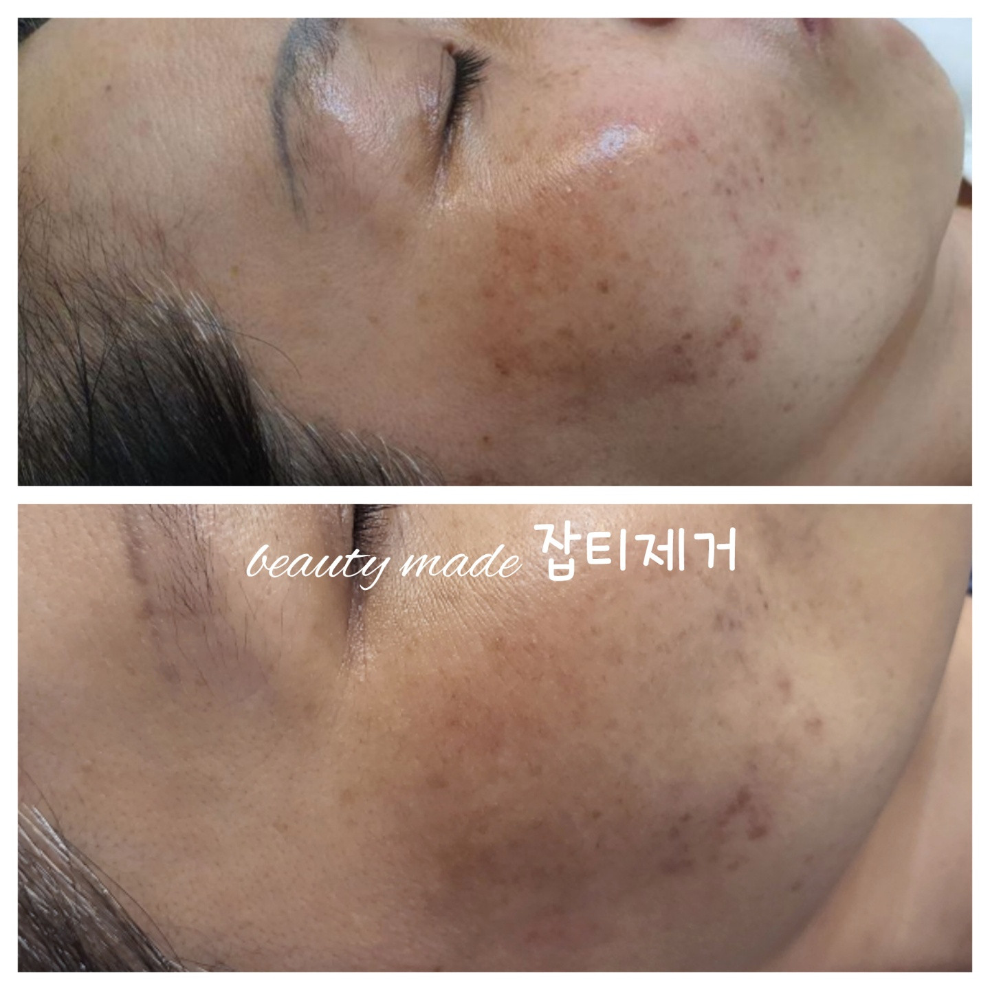 뷰티메이드피부샵