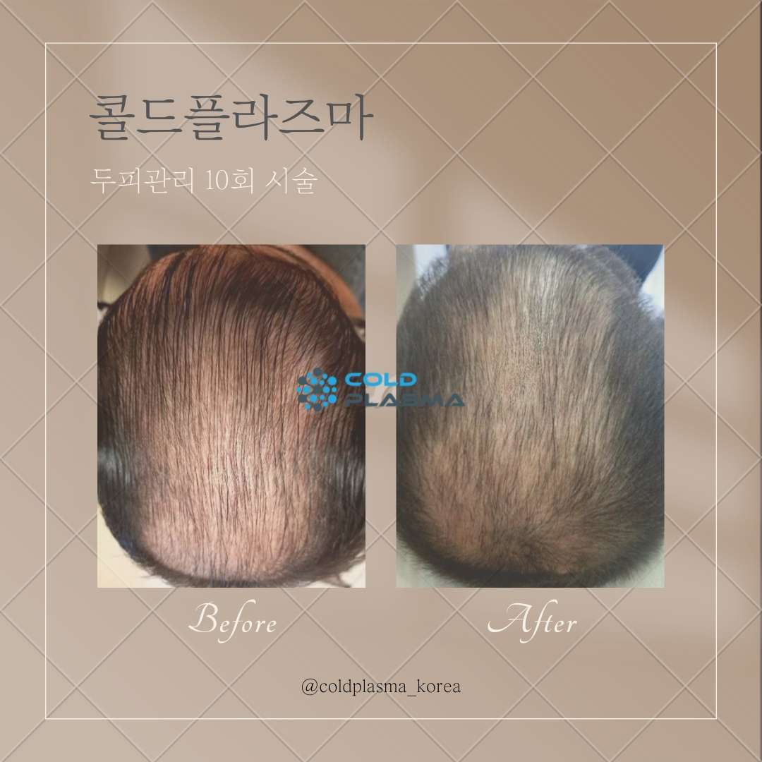 예쁨주의