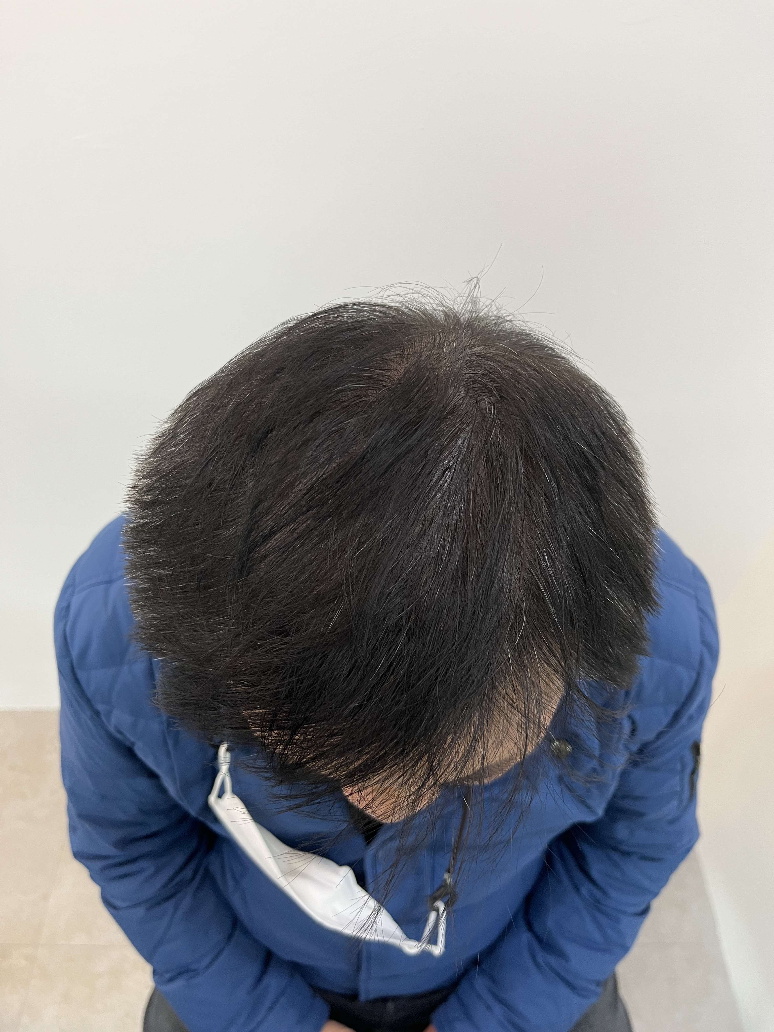 돋음스칼프