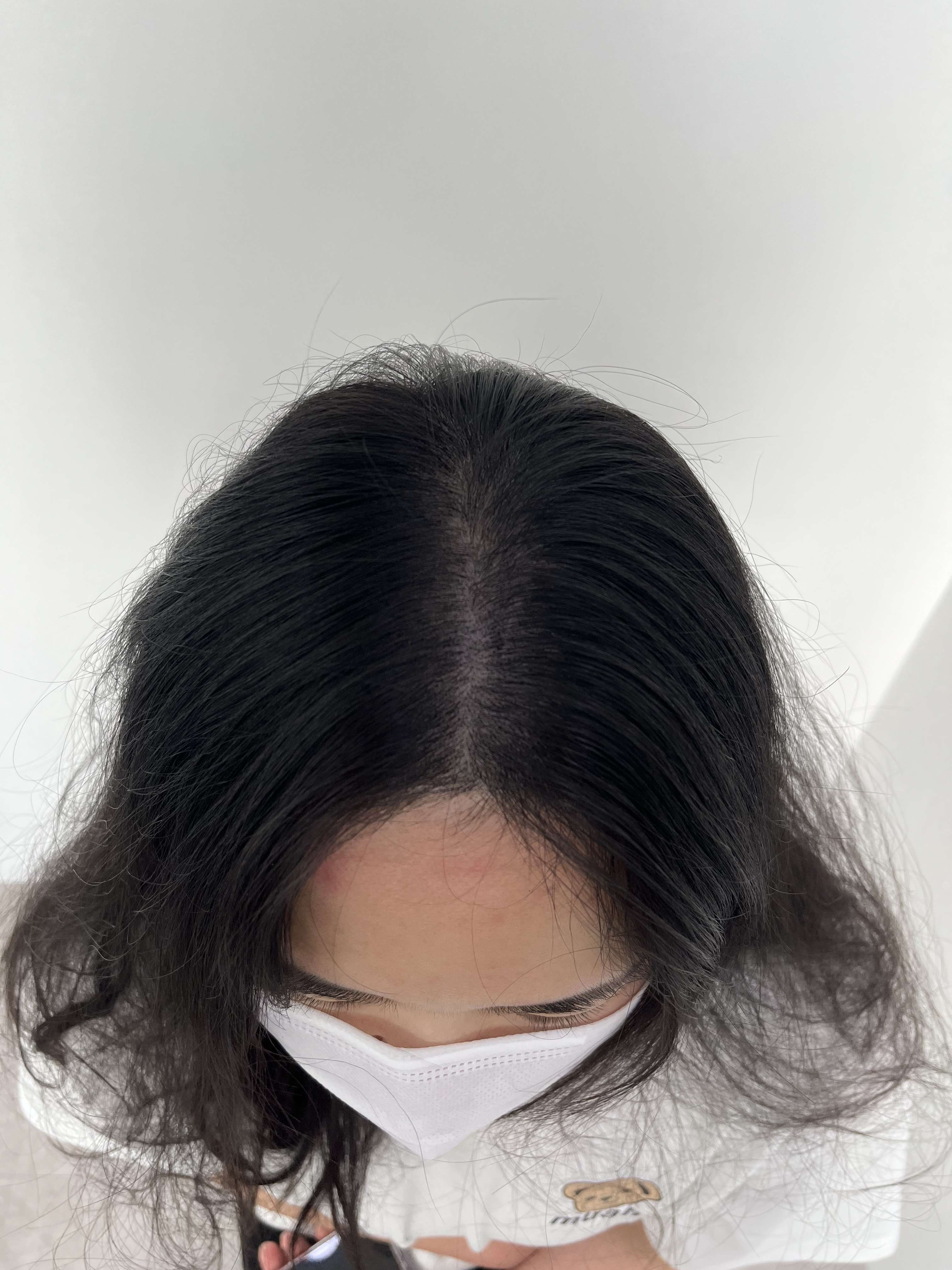 돋음스칼프