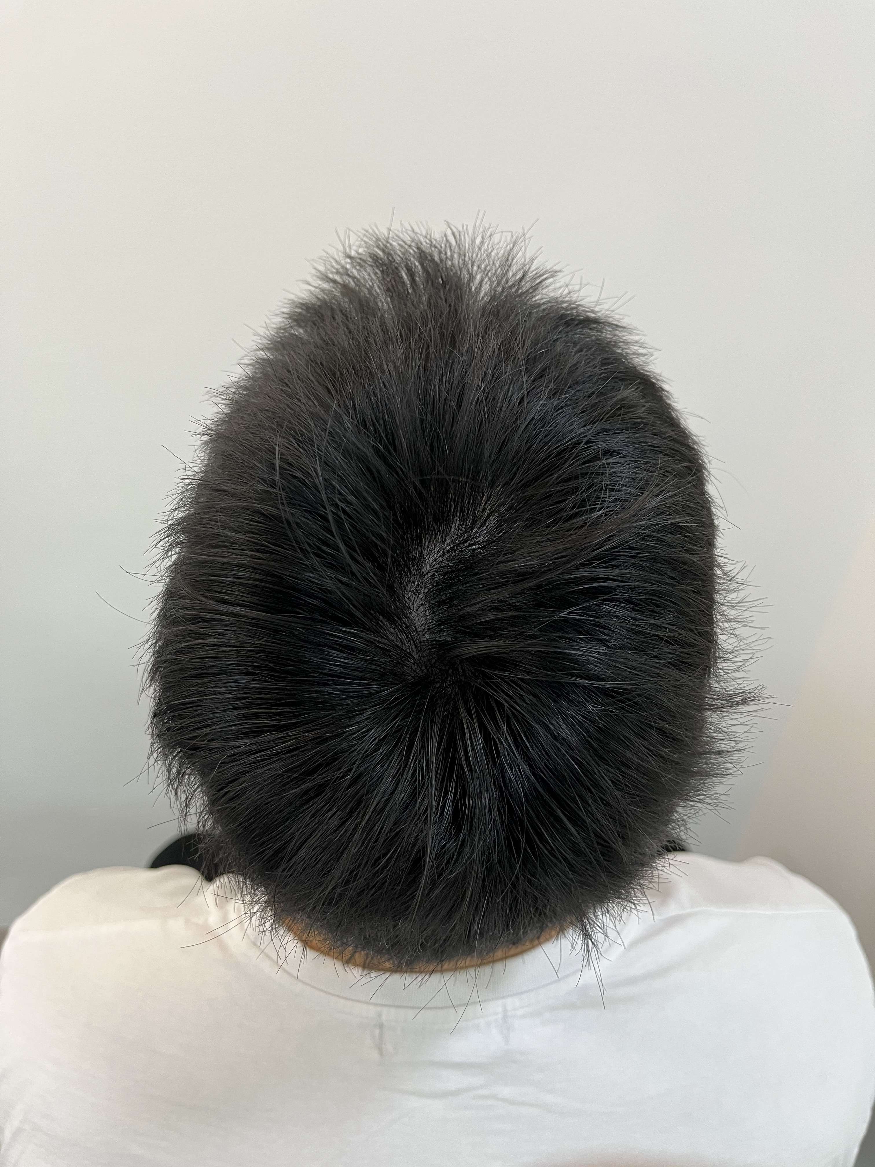 돋음스칼프