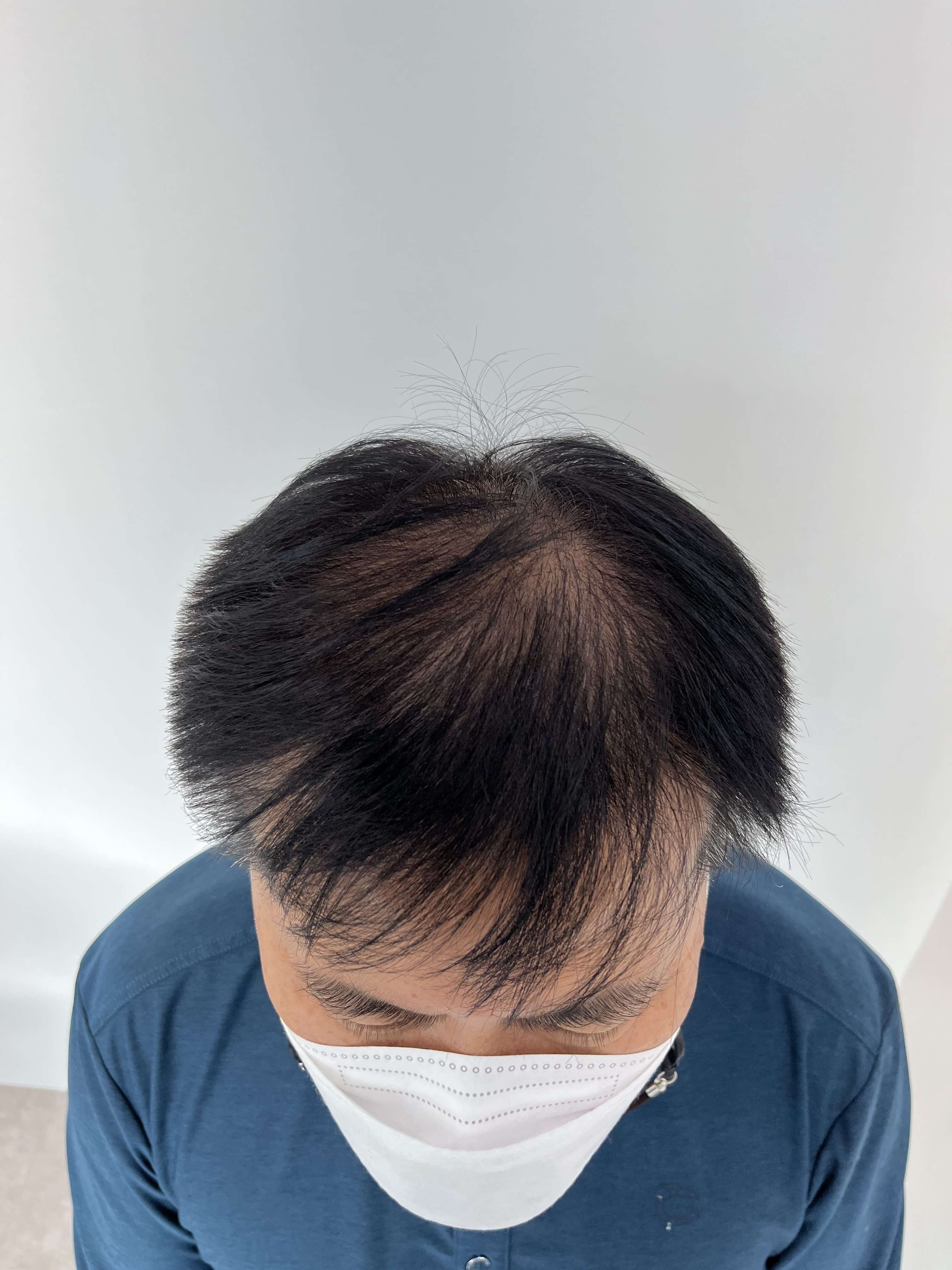 돋음스칼프