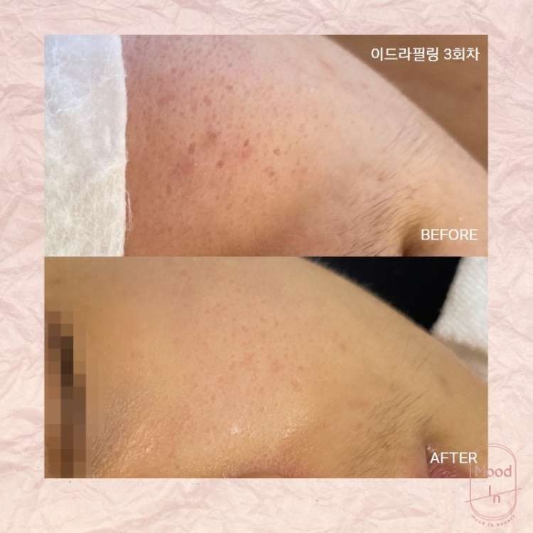 무드인뷰티