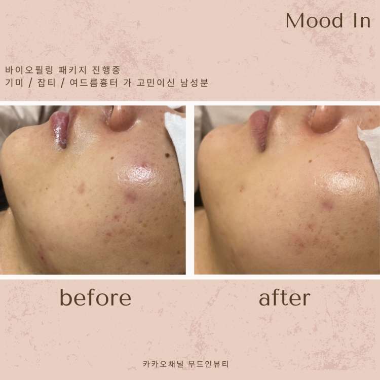 무드인뷰티