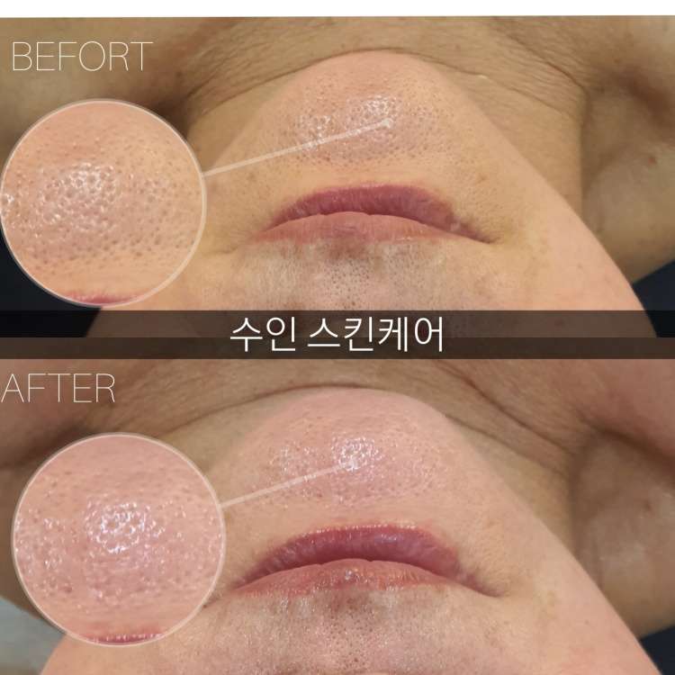 수인스킨케어
