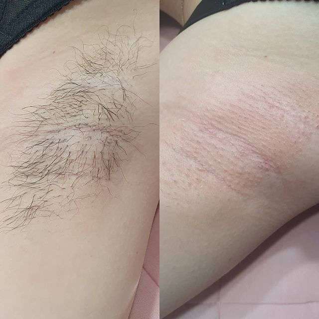 허니뷰티끄