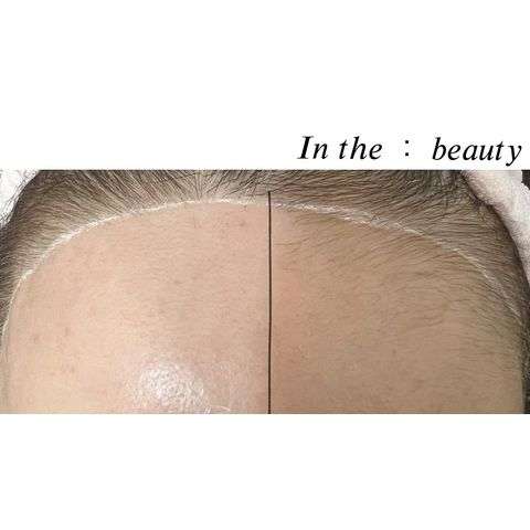 인더뷰티inthe:beauty