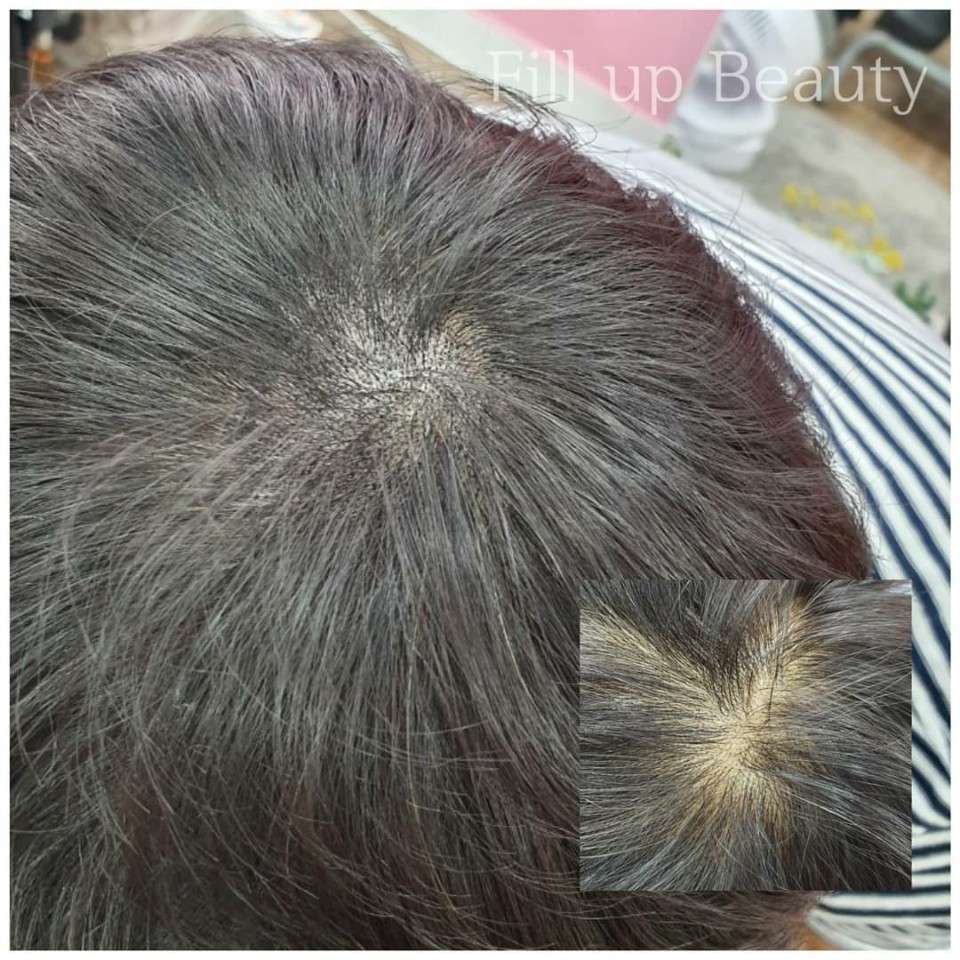 영뷰티랩