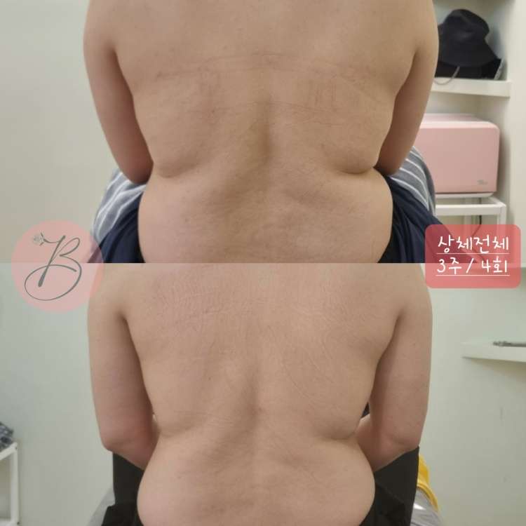 뷰티인로즈